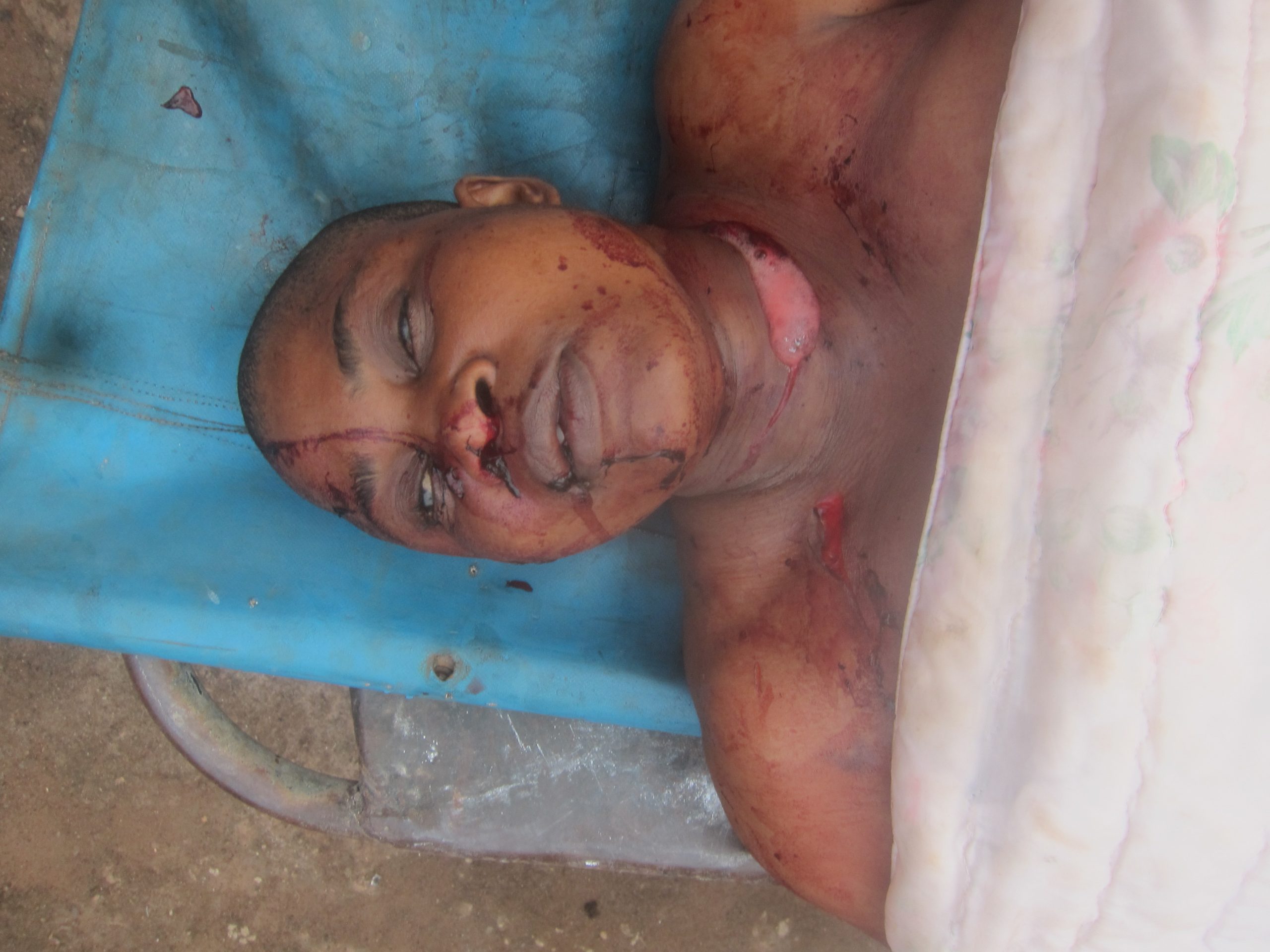 IMG_2526-scaled HUSBAND SLITS WIFE’S THROAT, COMMITS SUICIDE